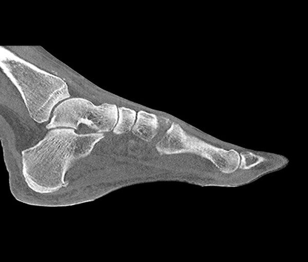 Anatomy Phantom Models for CT,  X-Ray, and Radiation Therapy