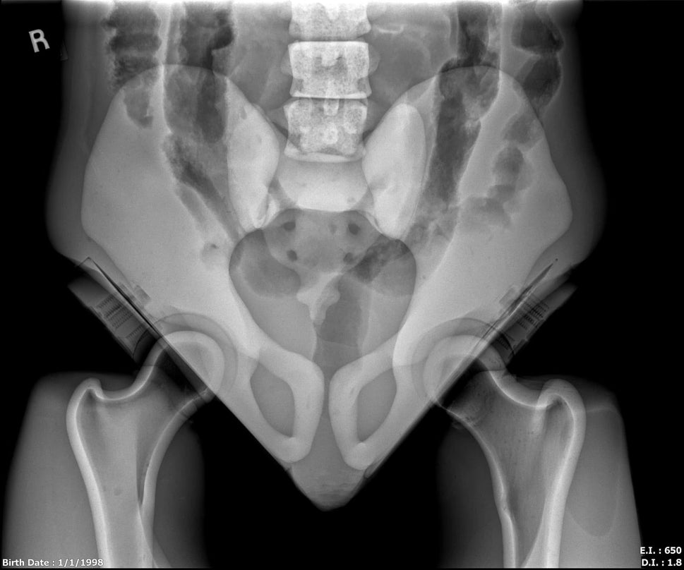Adult Full Body Phantom with Muscles for X-Ray CT, MRI