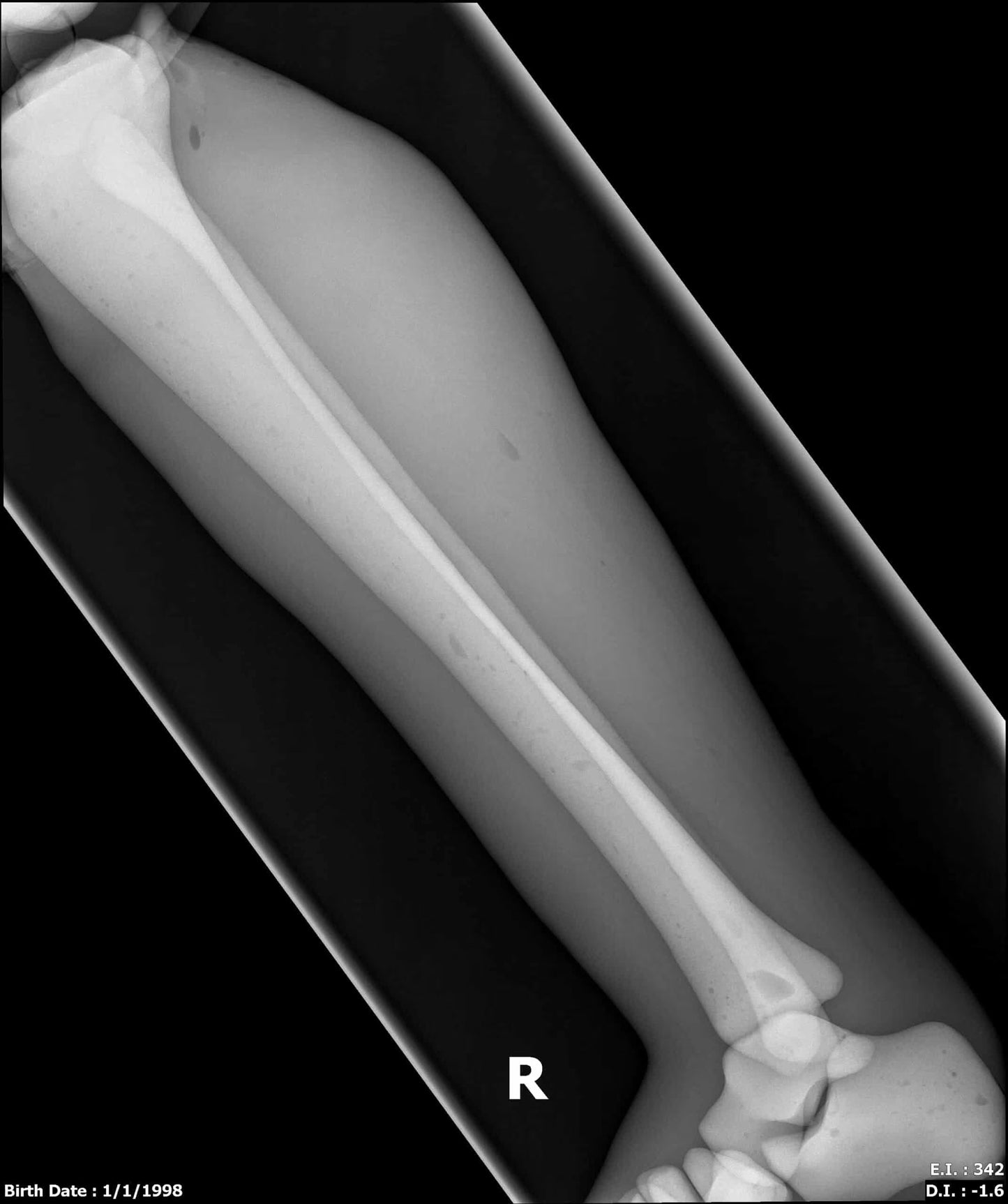 Adult Full Body with Muscles for X-Ray CT, MRI FB-A02 image 31