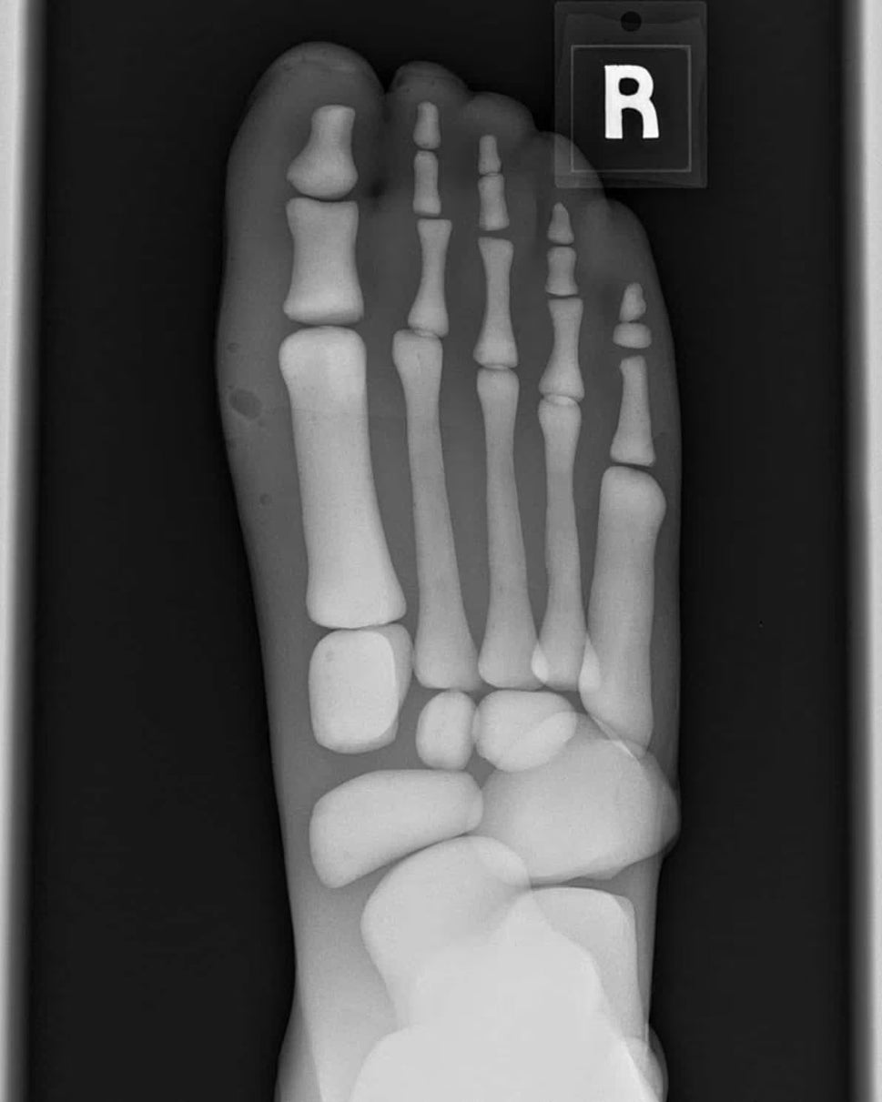 Adult Full Body Phantom with Muscles for X-Ray CT, MRI