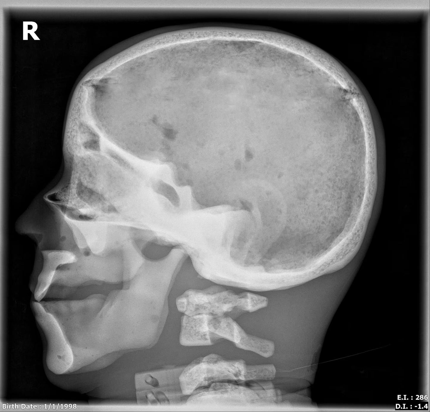 Adult Full Body with Muscles for X-Ray CT, MRI FB-A02 image 20