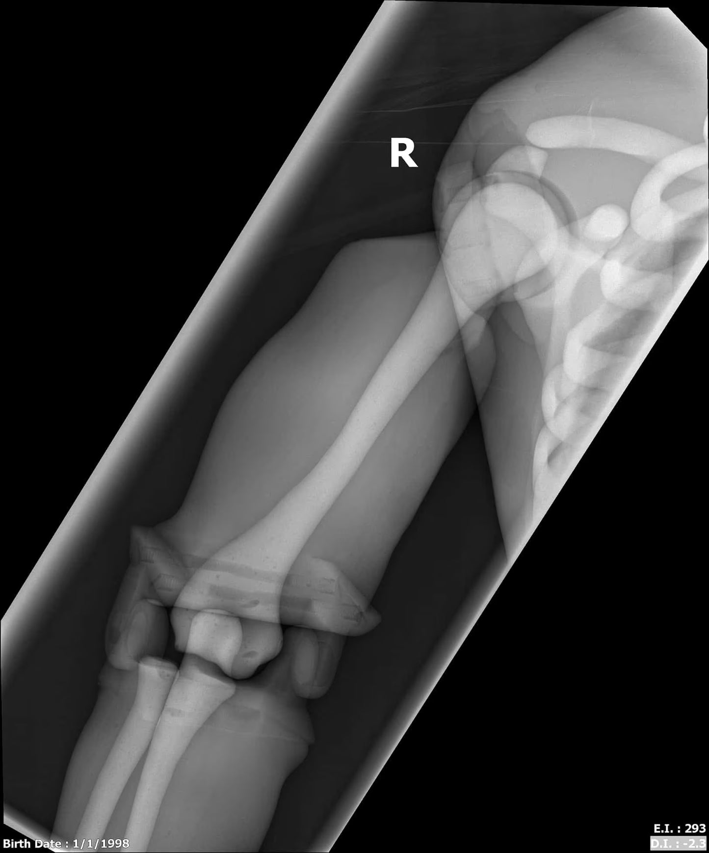 Adult Full Body with Muscles for X-Ray CT, MRI FB-A02 image 22