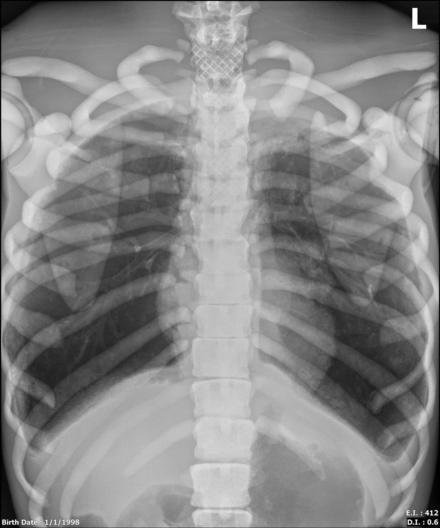 Adult Full Body with Muscles for X-Ray CT, MRI FB-A02 image 26