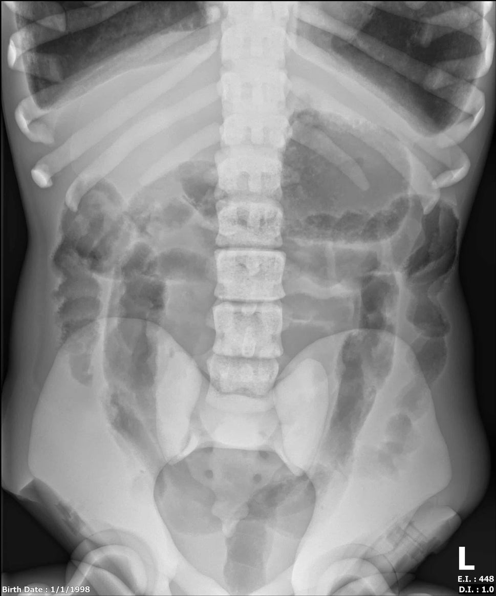 Adult Full Body Phantom with Muscles for X-Ray CT, MRI