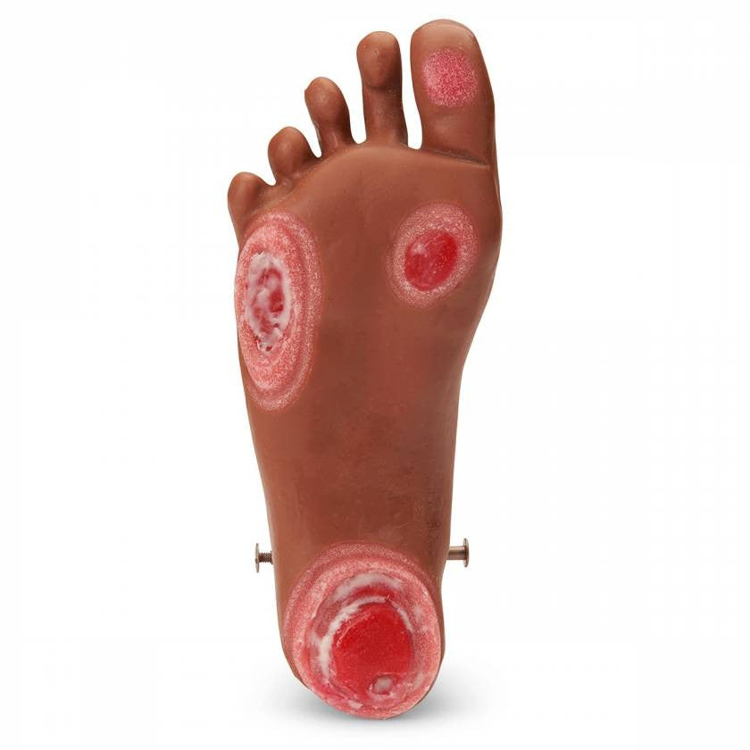 GERi/KERi Optional Pressure Injury Foot (Medium Skin Tone)