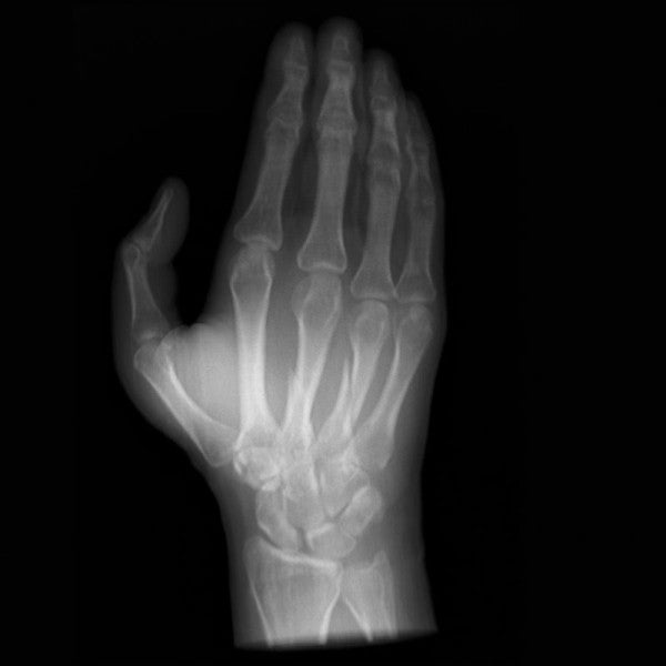 Anatomy Phantom Models for CT,  X-Ray, and Radiation Therapy