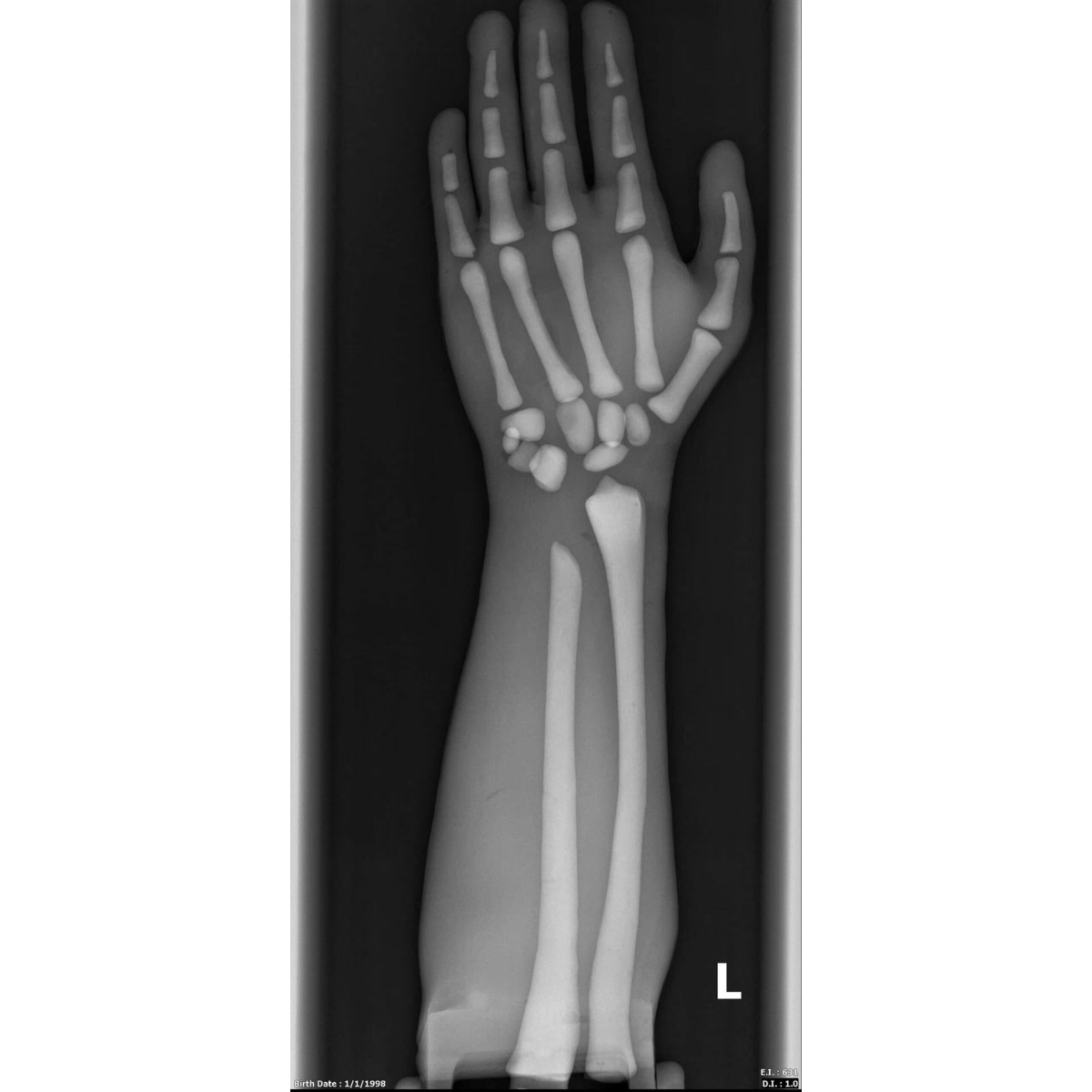 Adult Full Body Phantom with Muscles for X-Ray CT, MRI