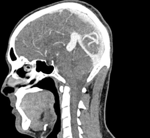 Anatomy Phantom Models for CT,  X-Ray, and Radiation Therapy