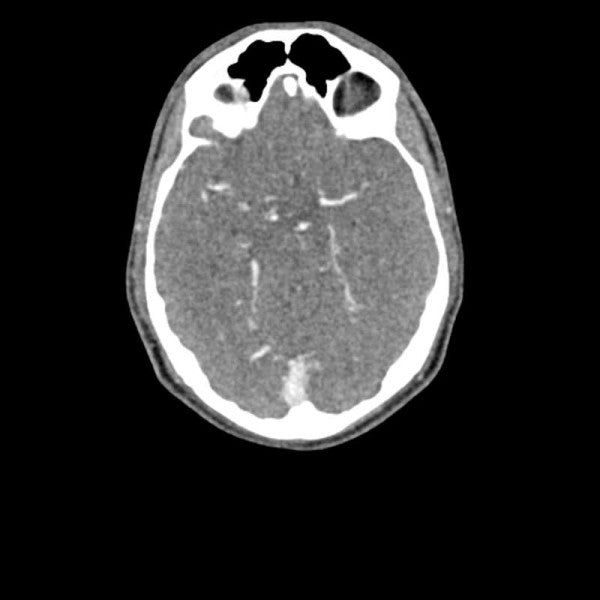 Anatomy Phantom Models for CT,  X-Ray, and Radiation Therapy