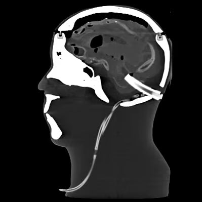 Adult Head (Dynamic, Advanced) for X-Ray CT, US, MRI HD-C03 image 6