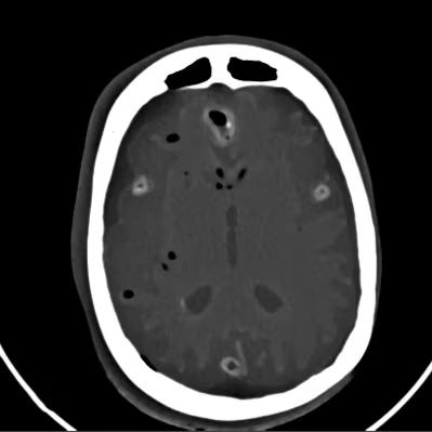 Adult Head (Dynamic, Advanced) for X-Ray CT, US, MRI HD-C03 image 11