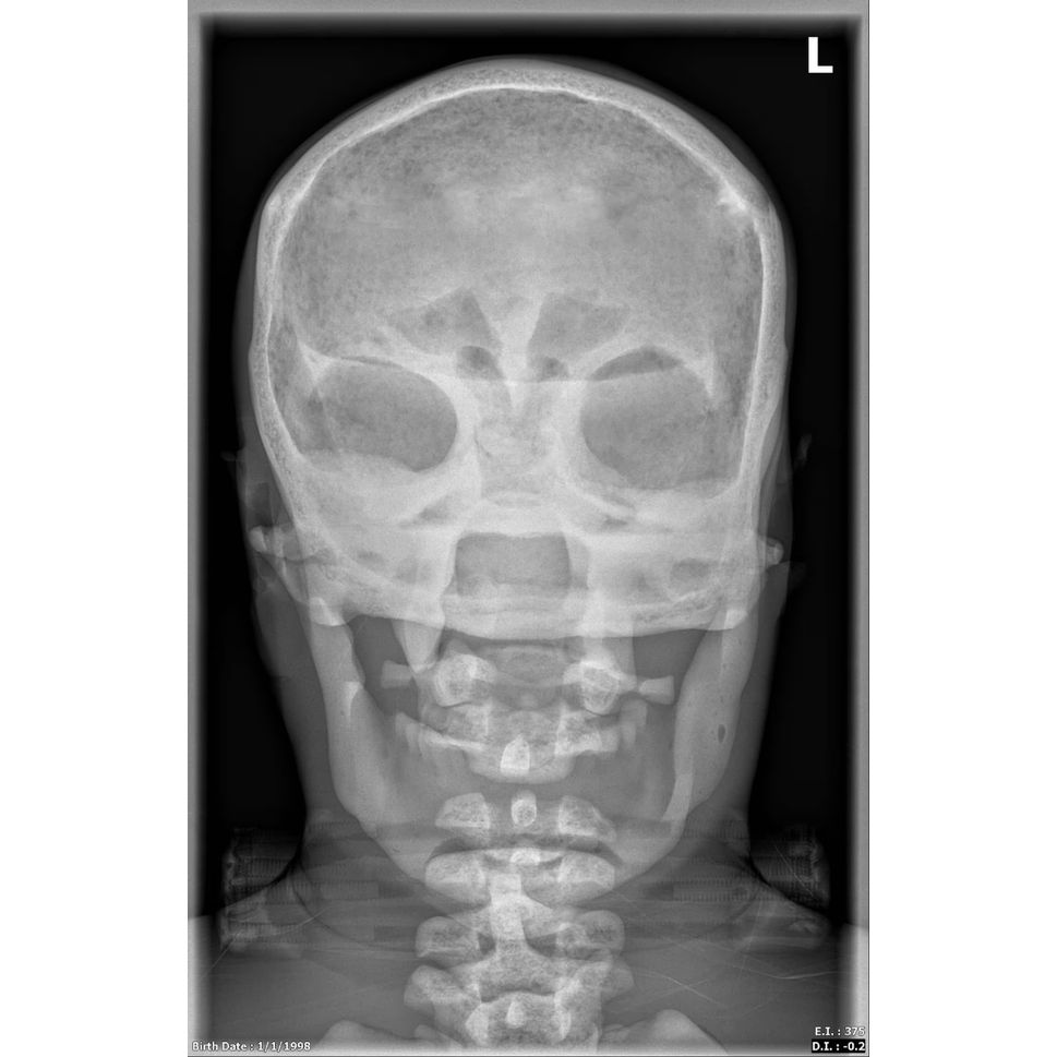 Adult Full Body Phantom with Muscles for X-Ray CT, MRI