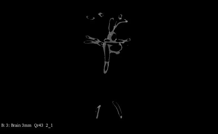 Adult Heart Phantom for X-Ray CT, US, MRI