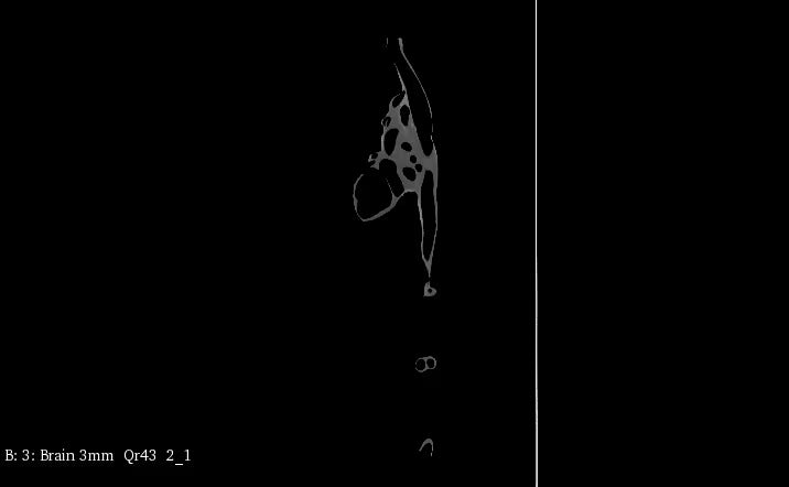 Adult Heart Phantom for X-Ray CT, US, MRI