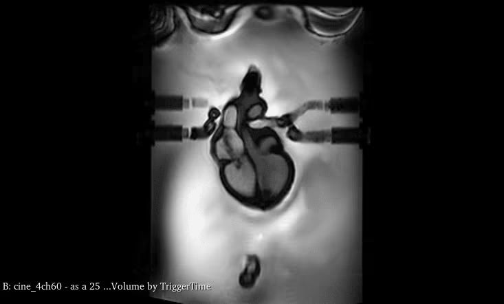 Adult Heart for X-Ray CT, US, MRI HT-A01 / HT-A02 image 9