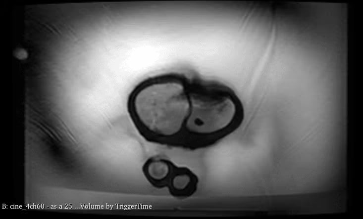 Adult Heart for X-Ray CT, US, MRI HT-A01 / HT-A02 image 10