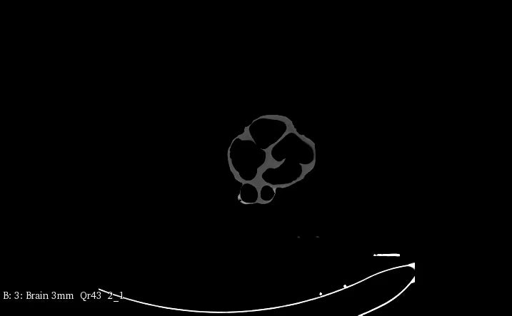 Adult Heart Phantom for X-Ray CT, US, MRI