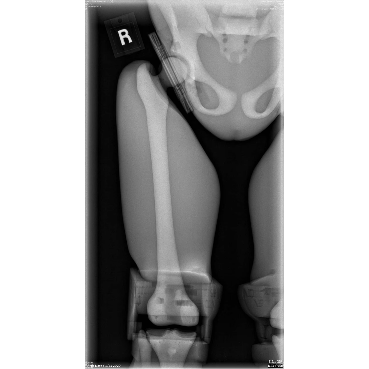 Paediatric Full Body for X-Ray CT, MRI FB-P01 image 15
