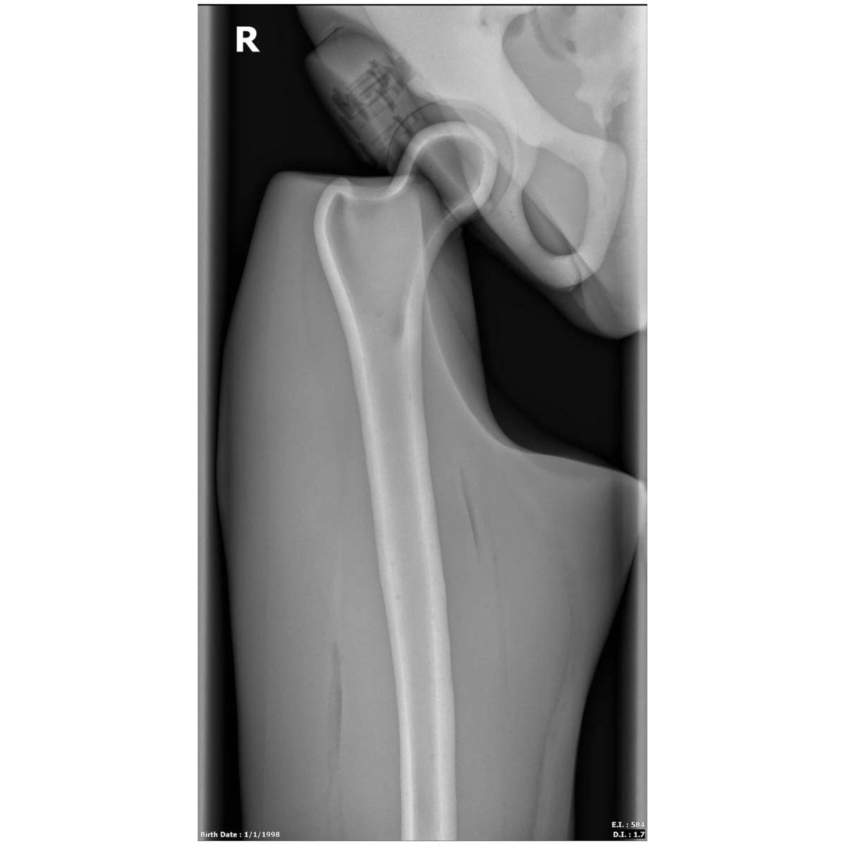 Adult Full Body Phantom with Muscles for X-Ray CT, MRI