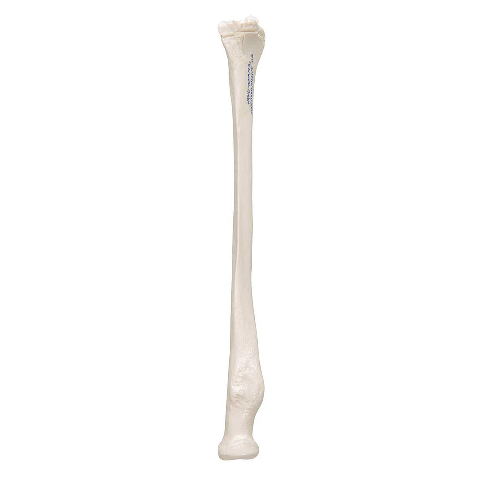 Human Radius Model