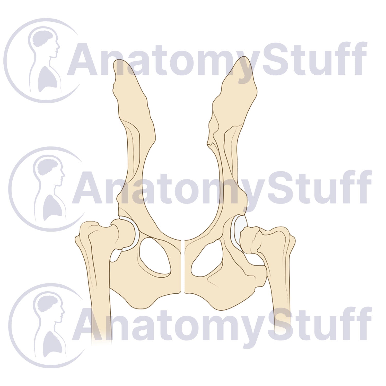Canine Hip Dysplasia Illustration