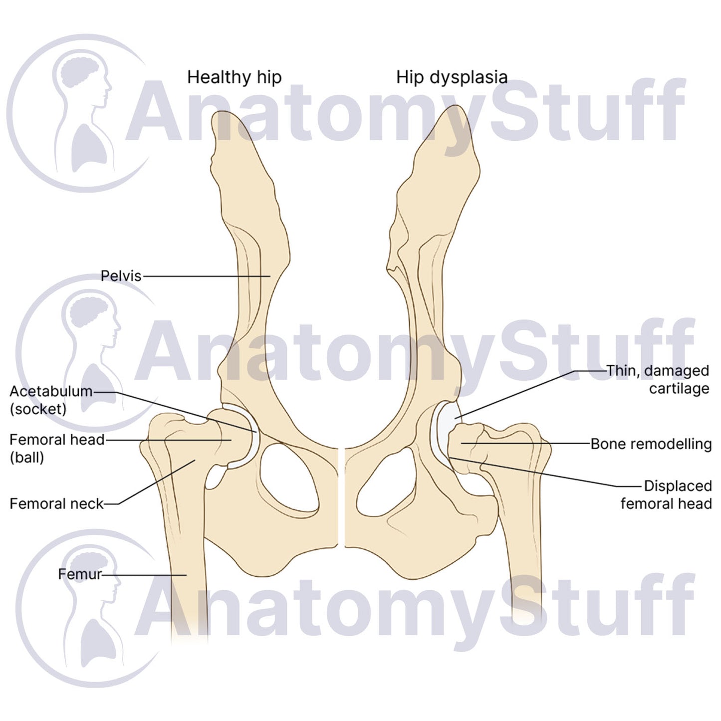 Canine Hip Dysplasia Illustration