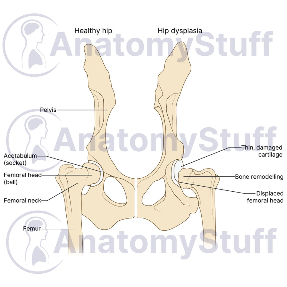 Canine Hip Dysplasia Illustration
