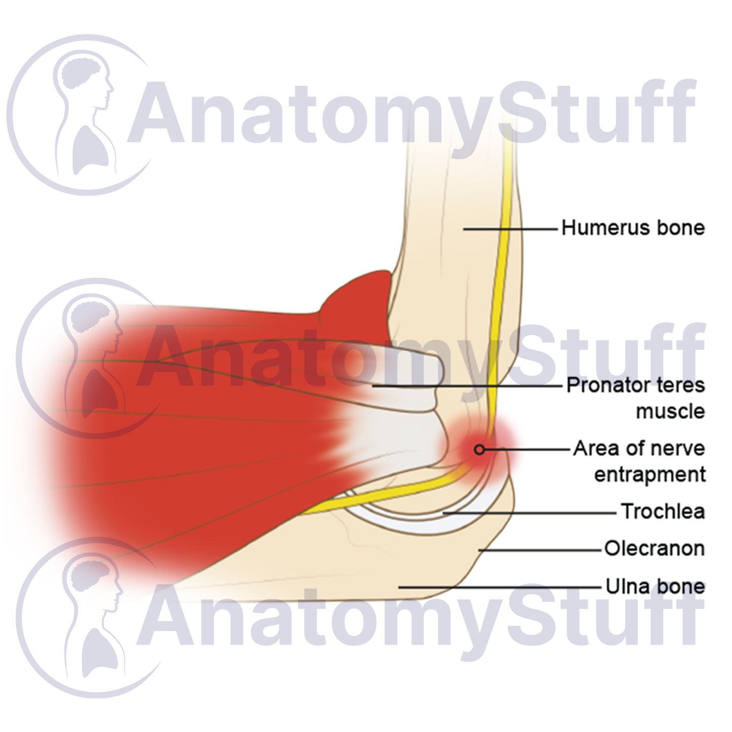 Cubital Tunnel Syndrome Illustration