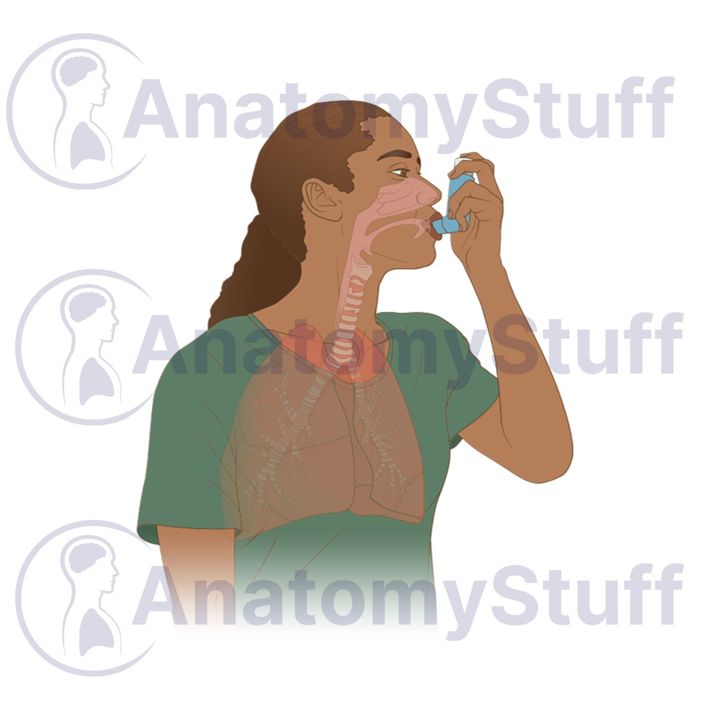 Asthma Illustration