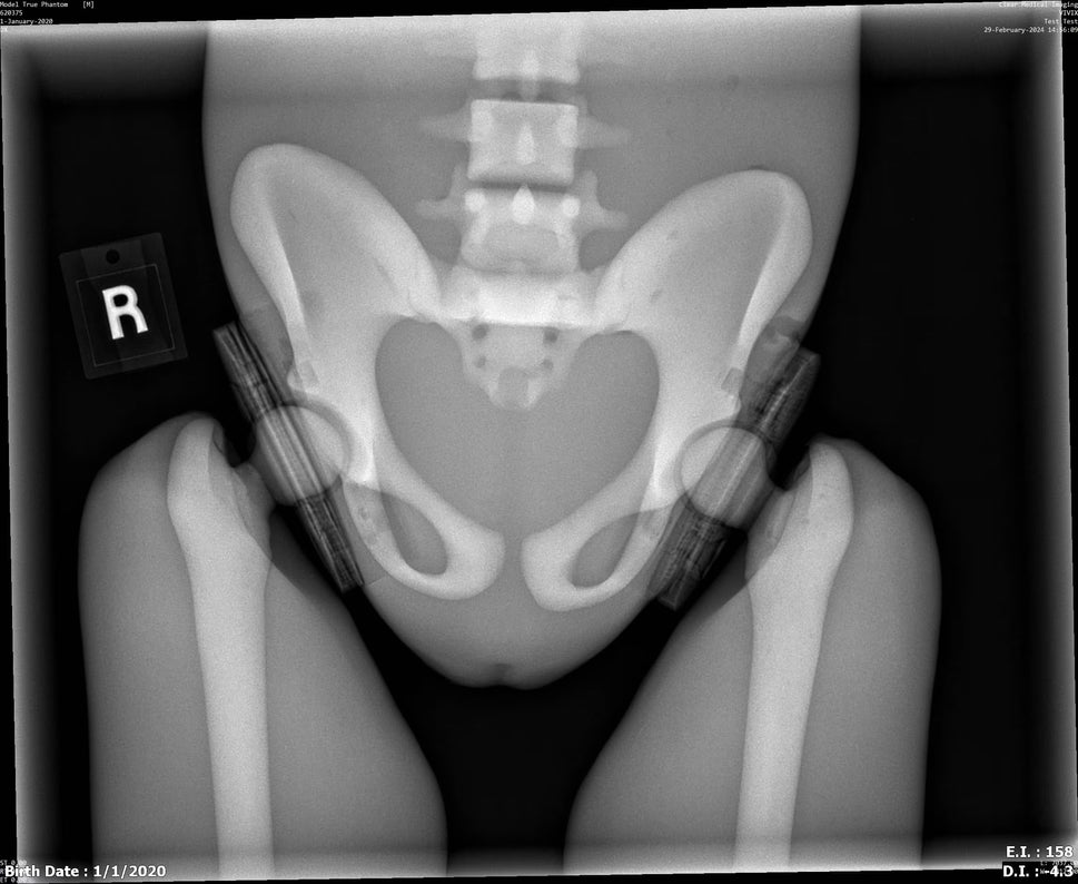 Paediatric Full Body Phantom for X-Ray CT, MRI