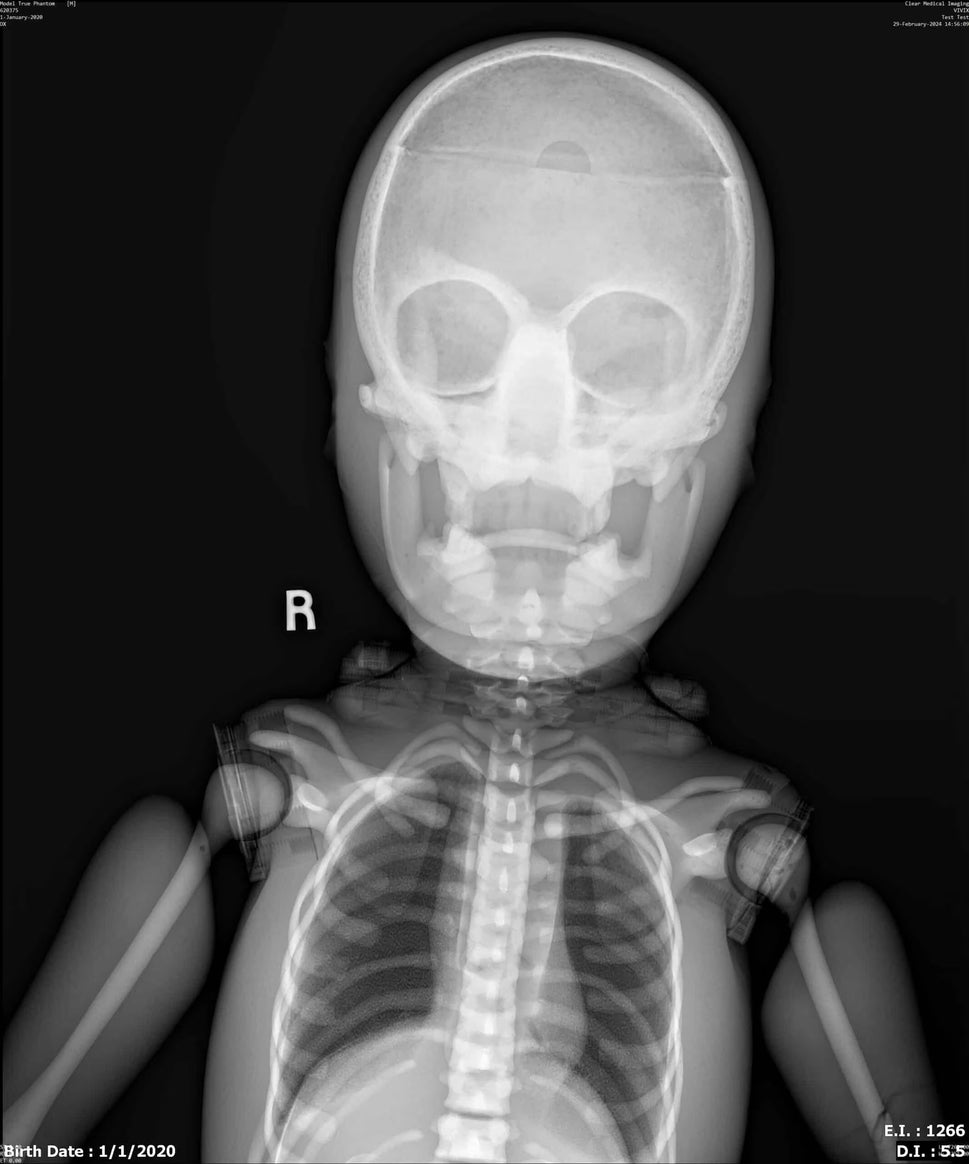 Paediatric Full Body Phantom for X-Ray CT, MRI