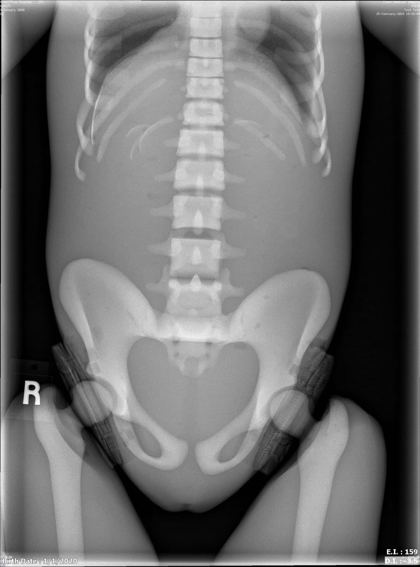 Paediatric Full Body for X-Ray CT, MRI FB-P01 image 8