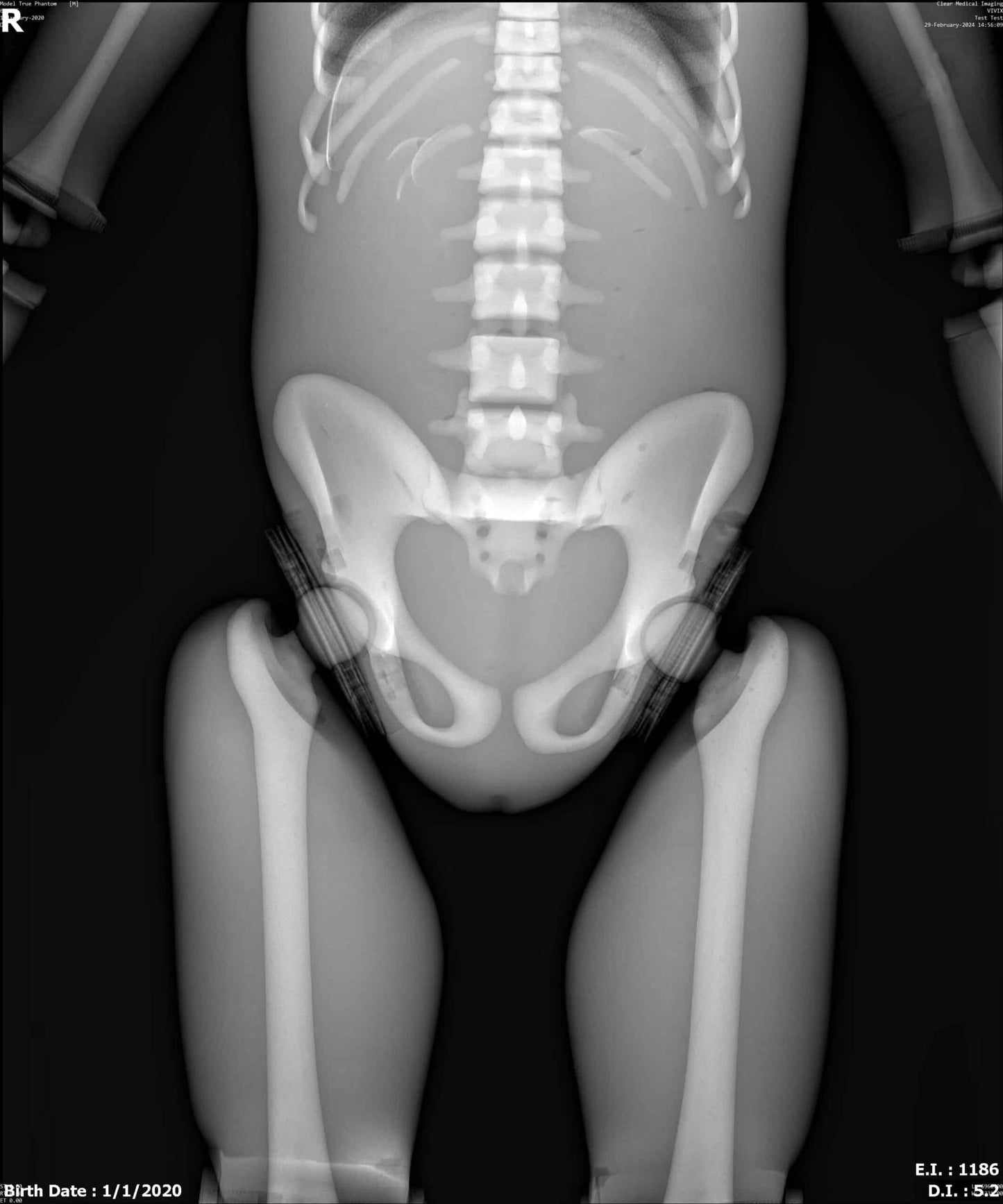 Paediatric Full Body for X-Ray CT, MRI FB-P01 image 9