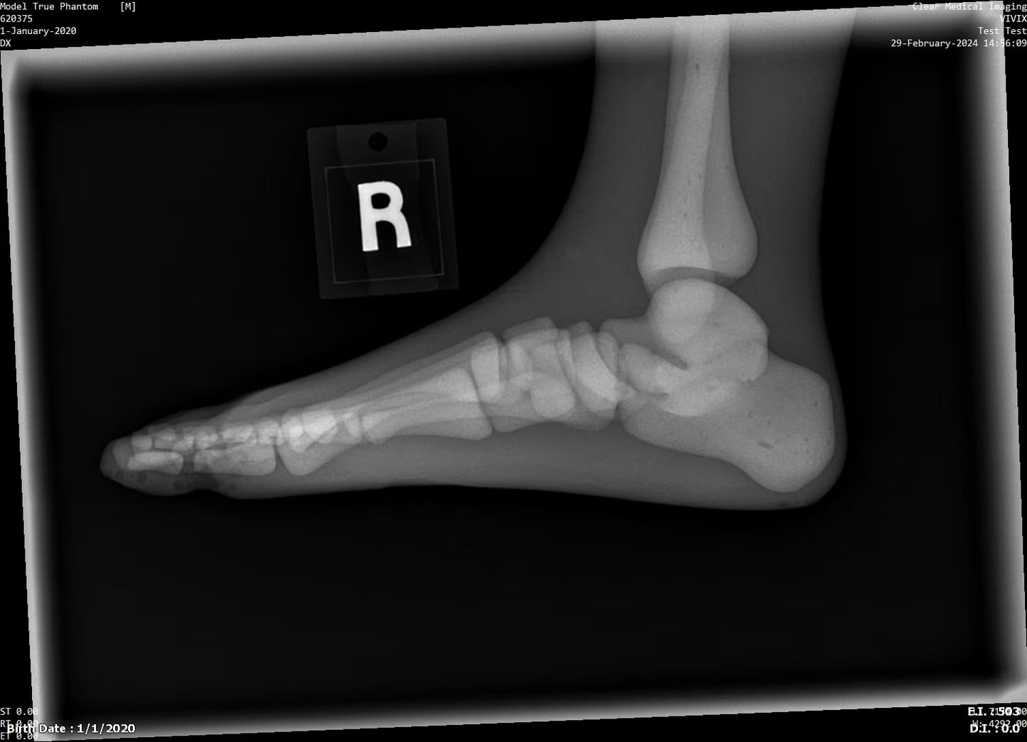 Paediatric Full Body for X-Ray CT, MRI FB-P01 image 10