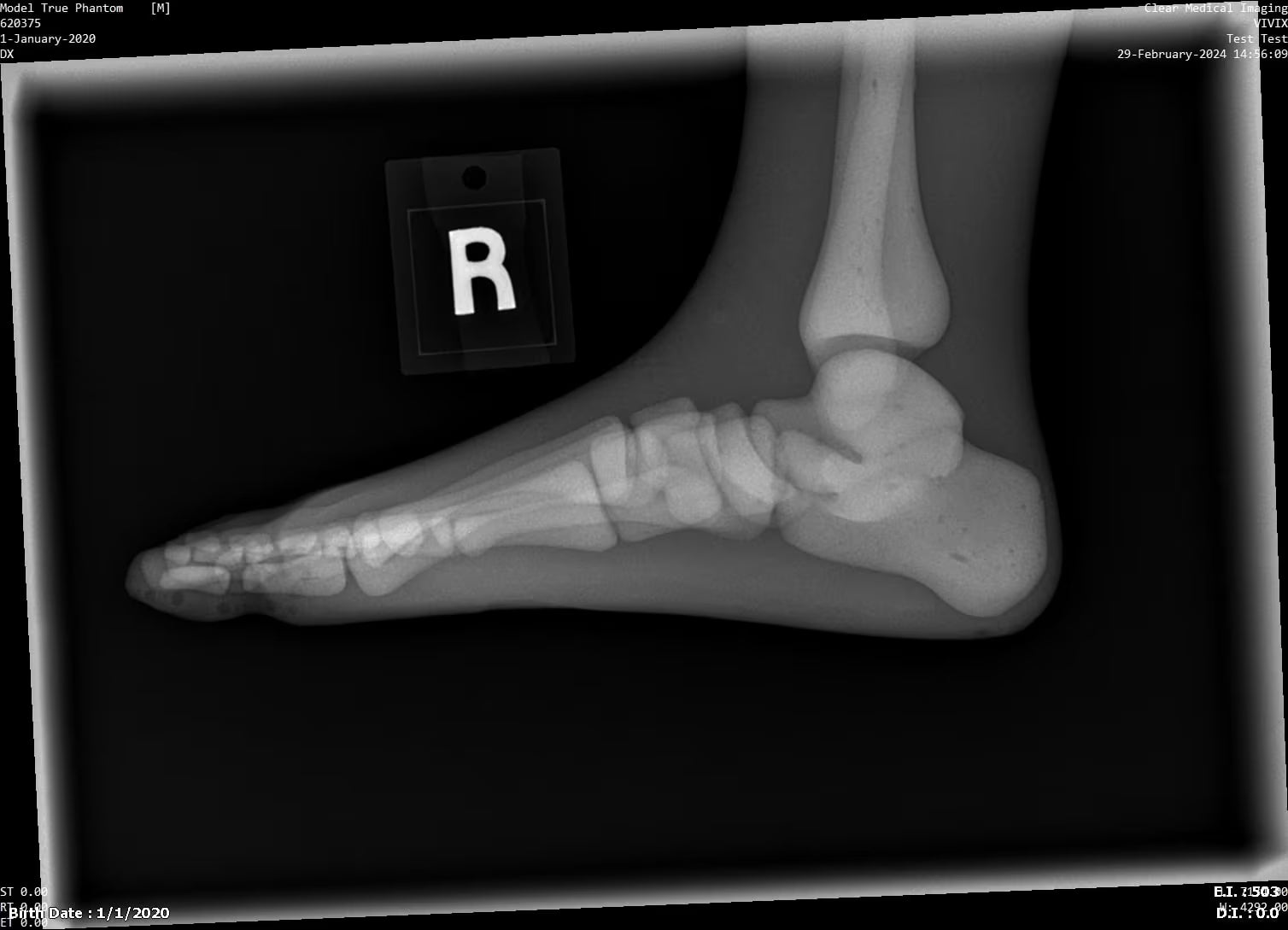 Paediatric Full Body Phantom for X-Ray CT, MRI