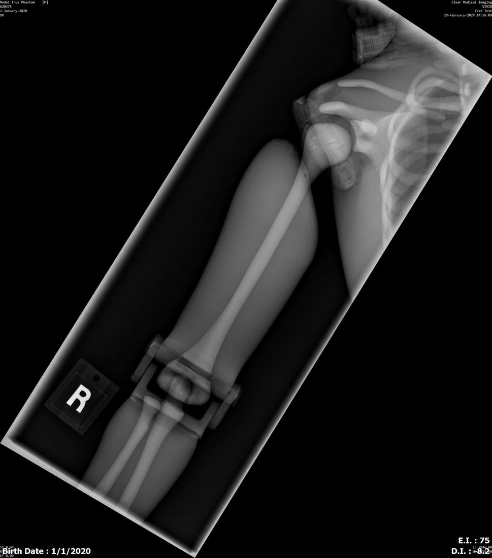 Paediatric Full Body Phantom for X-Ray CT, MRI
