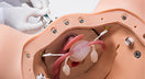 Switch Intrauterine Device Placement 2 image