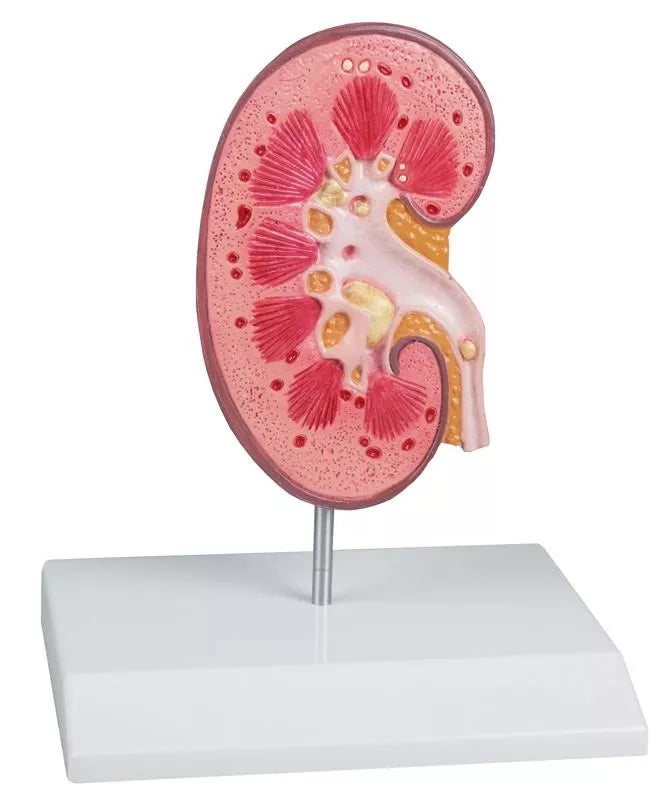 Kidney Stone Model (With Augmented Anatomy App) K229