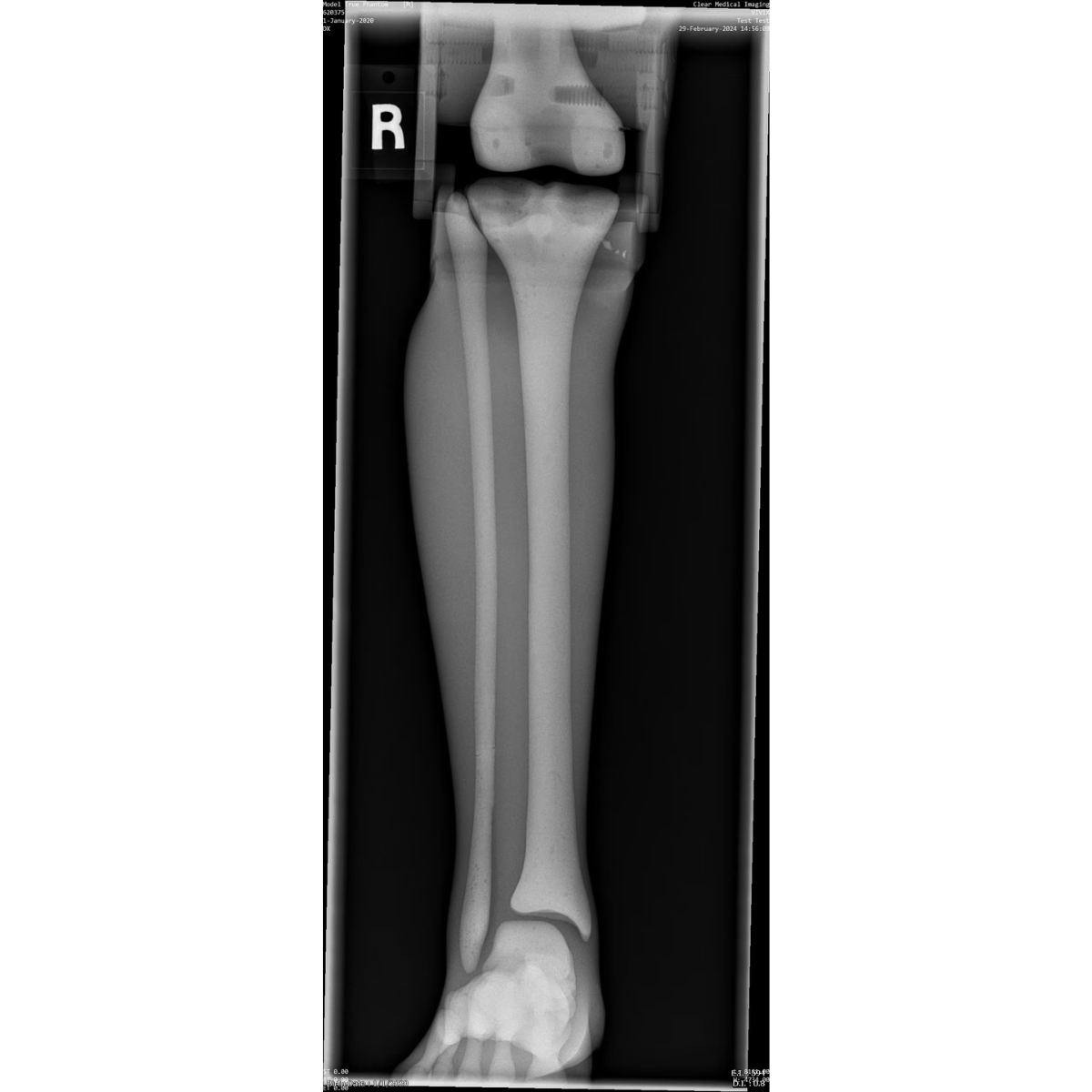 Paediatric Full Body Phantom for X-Ray CT, MRI