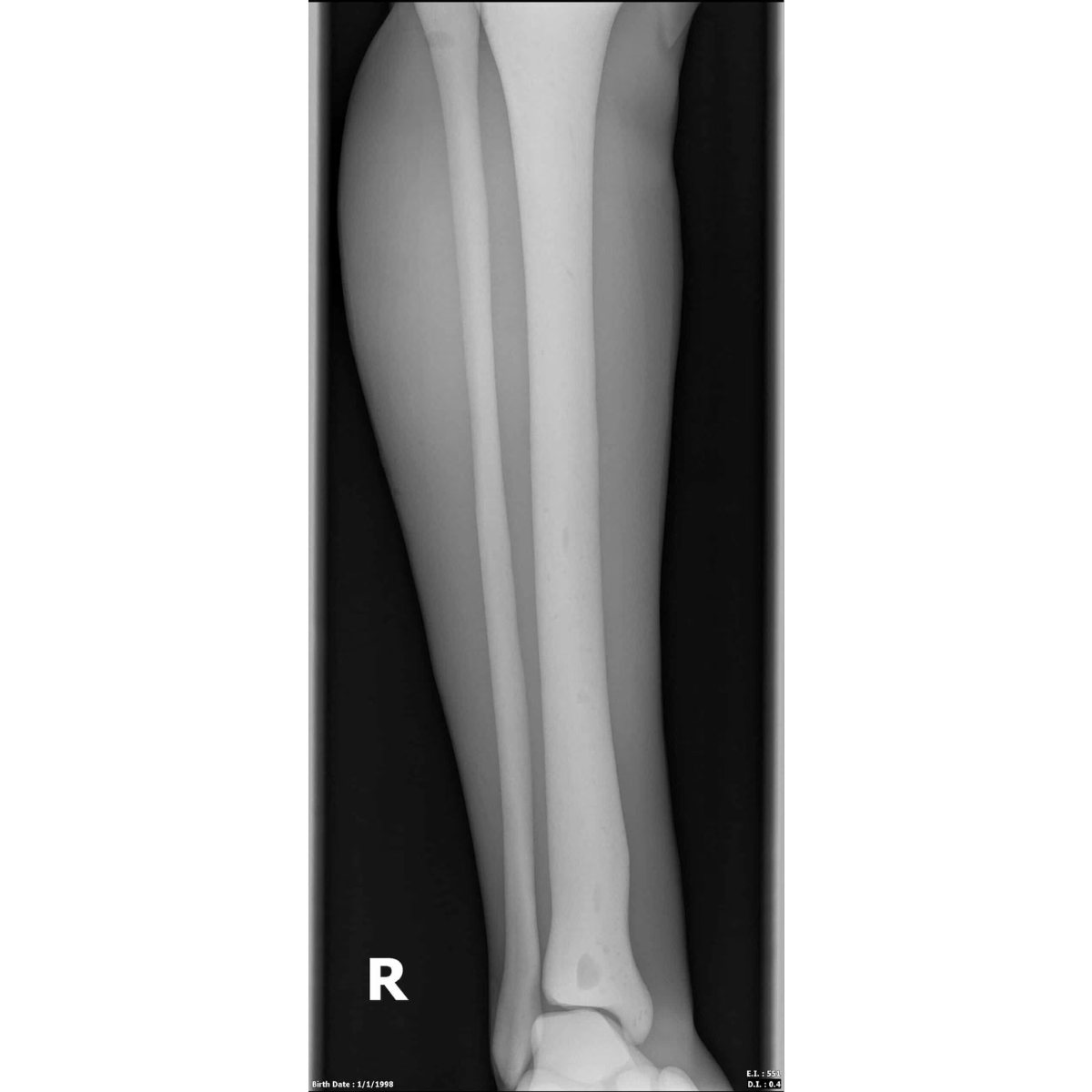 Adult Full Body with Muscles for X-Ray CT, MRI FB-A02 image 34