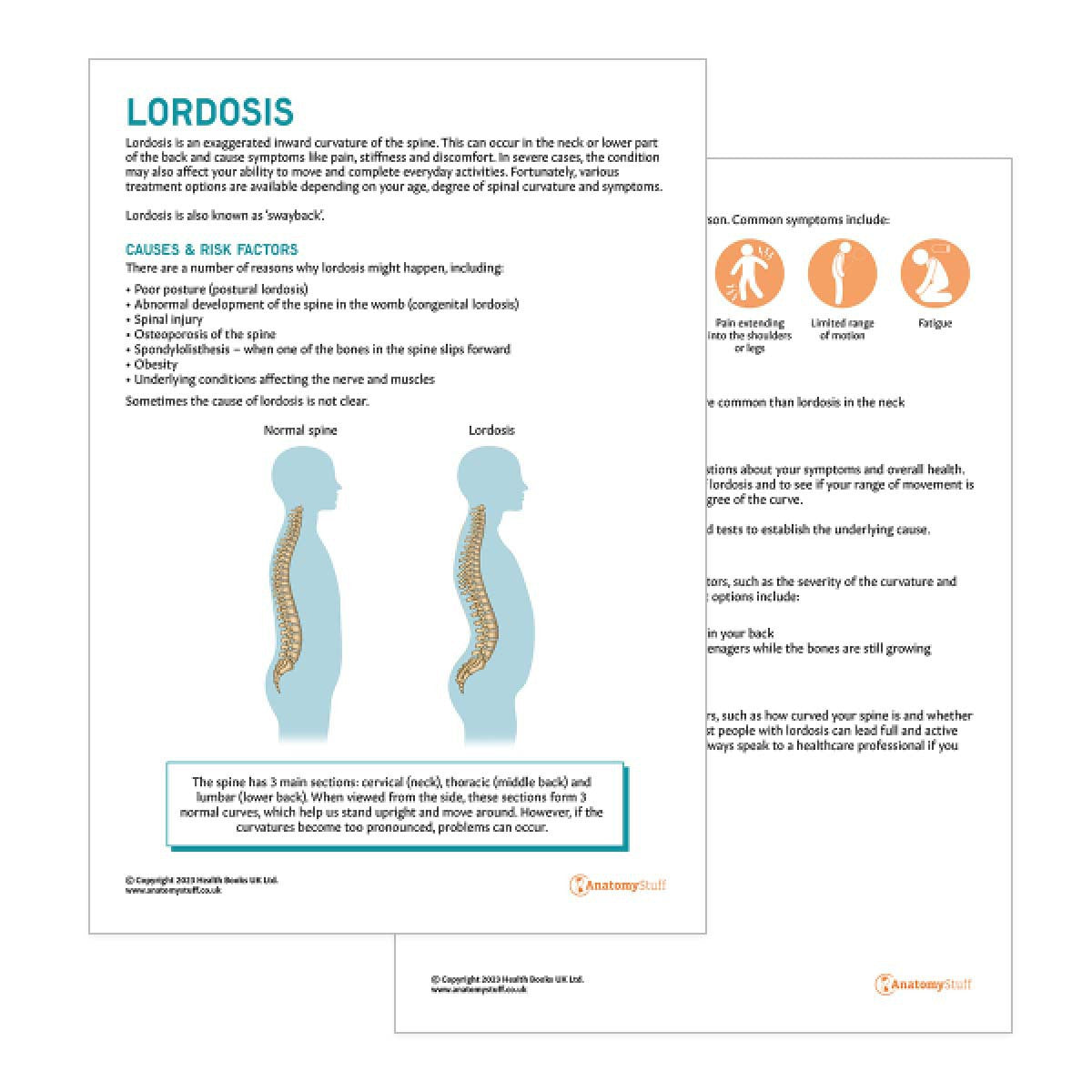 Lordosis Patient Education Handout