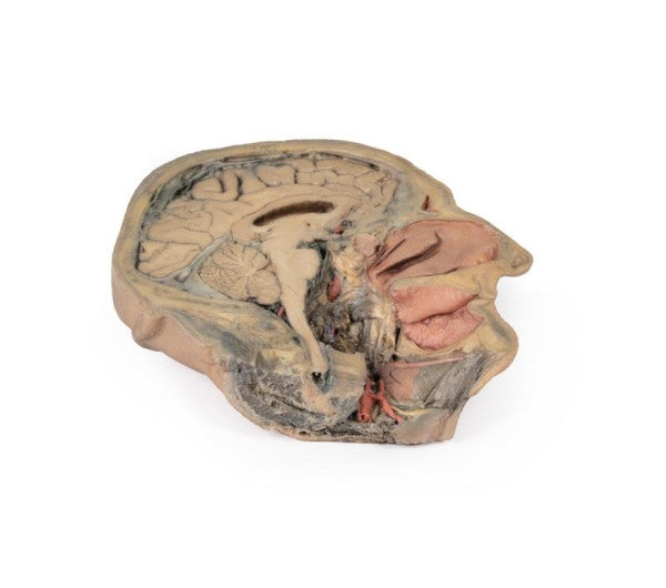 Median Section Through Head (Sagittal Section of Head with Deep Dissection) Model