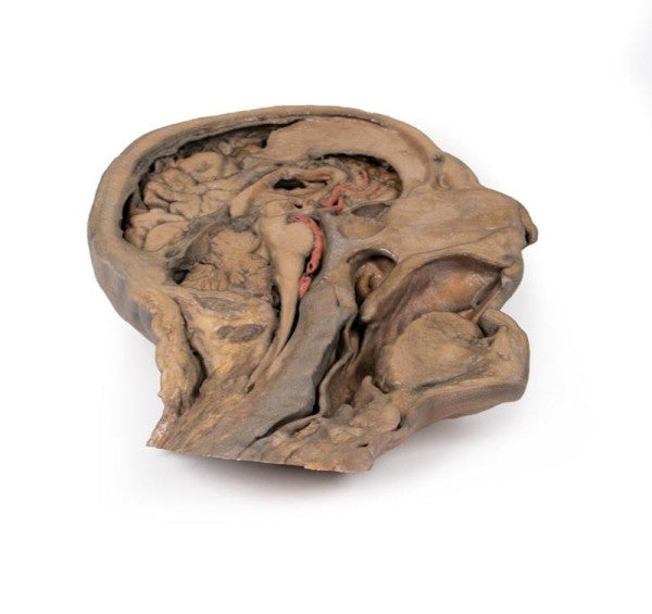 Head and Neck 3D Printed Anatomy Model