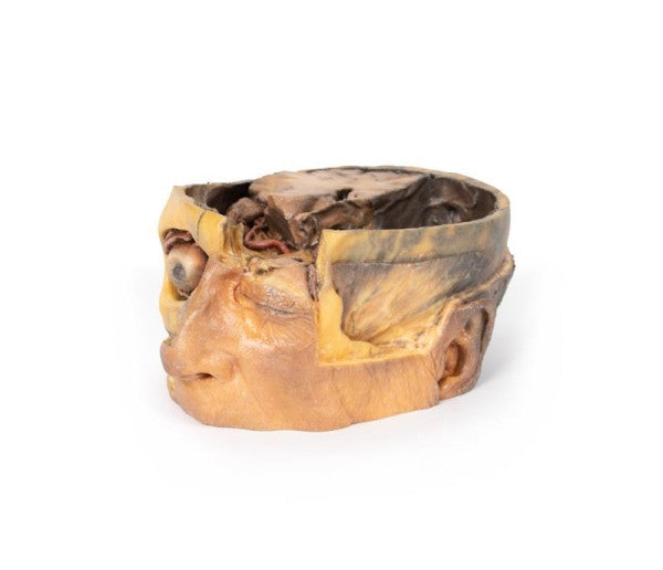 3D Printed Anatomy Model of the Head