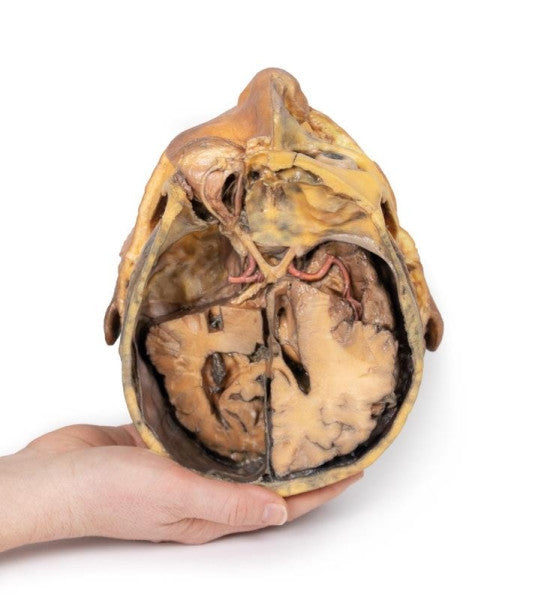 Head and Neck 3D Printed Anatomy Model