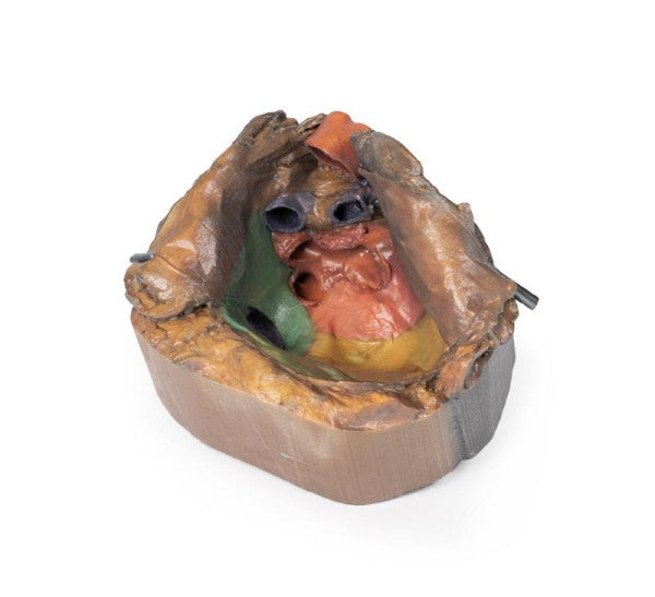 Anterior View of the Pericardial Space 3D Printed Anatomy Model