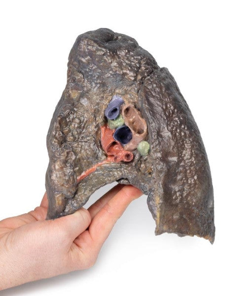 Lung 3D Printed Anatomy Model