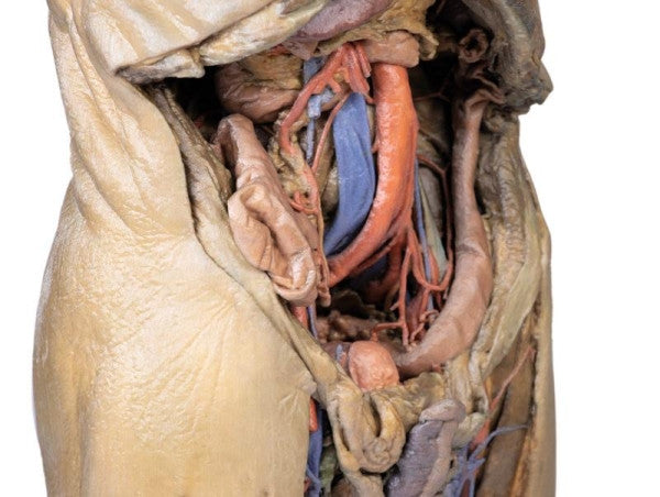 Abdomen 3D Printed Anatomy Model