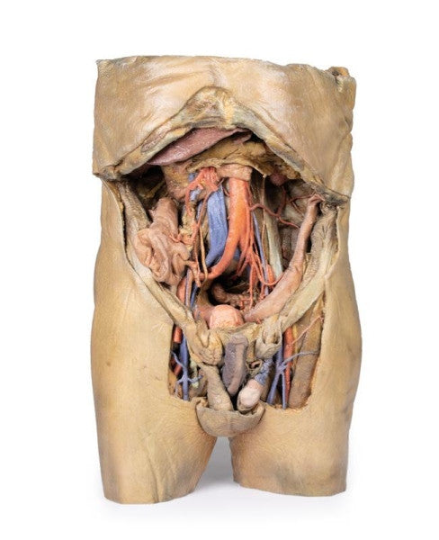 Abdomen 3D Printed Anatomy Model