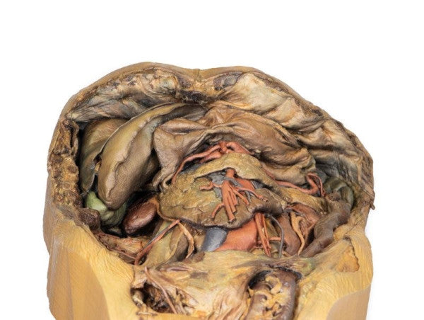 Abdomen 3D Printed Anatomy Model